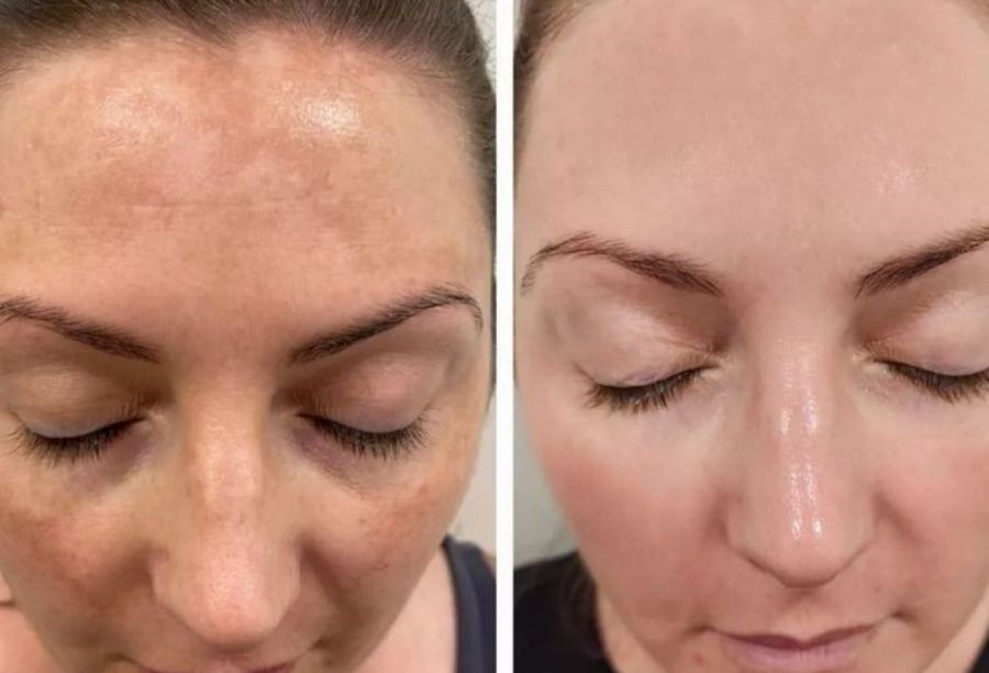 Before / After