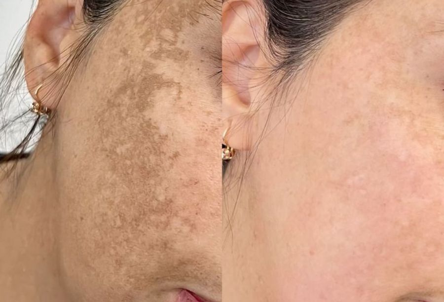 Before / After